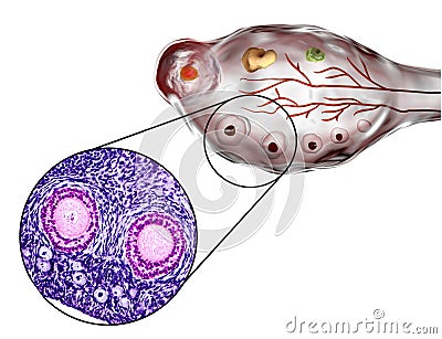 Ovarian follicles, micrograph and illustration Cartoon Illustration