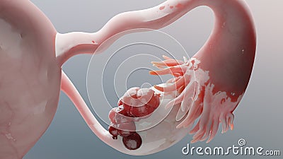 Ovarian malignant tumor, Female uterus anatomy, Reproductive system, cancer cells, ovaries cysts, cervical cancer, growing cells Stock Photo