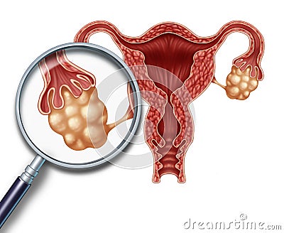 Ovaries concept Cartoon Illustration