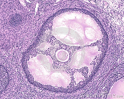 Ovary. Antral or tertiary follicle Stock Photo