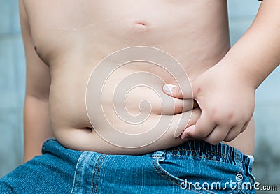 Overweight children Stock Photo