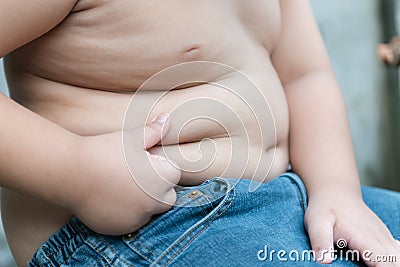 Overweight children Stock Photo