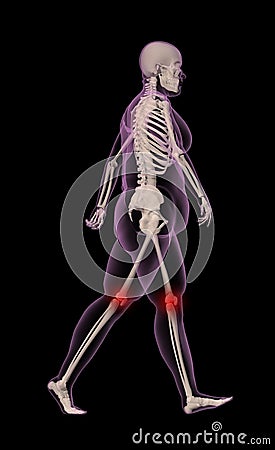 Overweight female skeleton walking Stock Photo