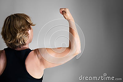 Overweight Lady Arm With Excess Fat Stock Photo