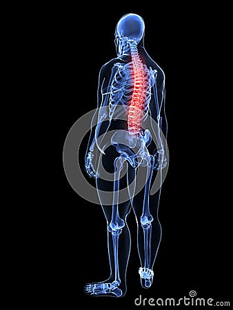 Overweight man - painful spine Cartoon Illustration