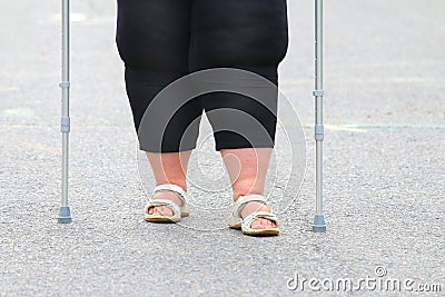 Overweight patient with crutches. Stock Photo
