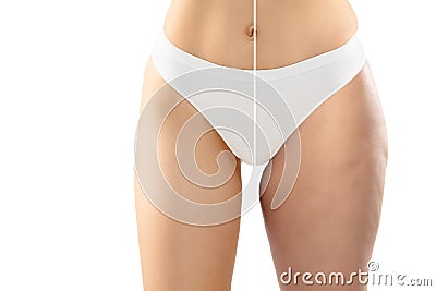 Overweight woman with fat cellulite legs and belly, obesity female body in white underwear comparing with fit and thin Stock Photo