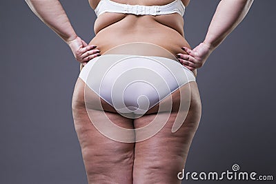Overweight woman with fat legs and buttocks, obesity female body Stock Photo