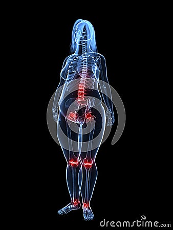 Overweight woman - painful joints Cartoon Illustration