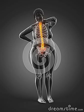 An overweight womans painful back Cartoon Illustration