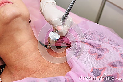 Oxygen mesotherapy. Anti-aging beauty treatment using hyaluronic acid. Stock Photo