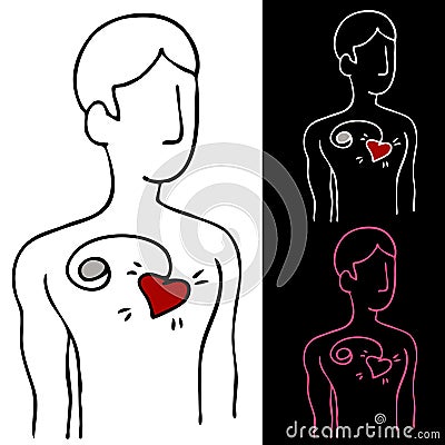 Pacemaker Vector Illustration
