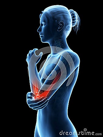 Pain in the elbow joint Stock Photo