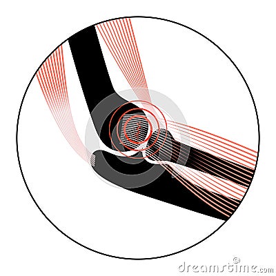 Lateral epicondylitis tennis elbow Vector Illustration