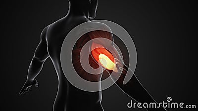 Pain and injury in the Triceps Muscles Stock Photo