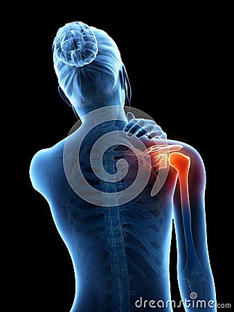 Pain in the shoulder joint Stock Photo
