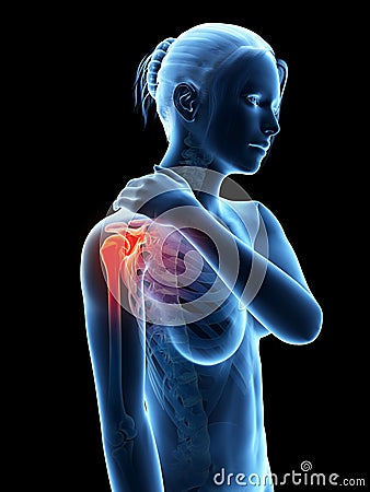 Pain in the shoulder joint Stock Photo