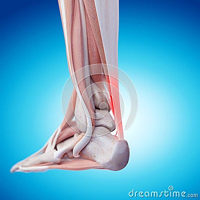 Painful achilles tendon Cartoon Illustration