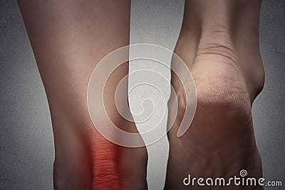 Painful ankle with red spot on woman's foot. Stock Photo