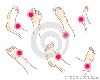 Painful feet and legs with ache mark collection. Muscle pain, medical and medicine concept. Isolated vector illustration Vector Illustration
