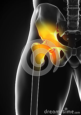 Painful Hip Joint Stock Photo