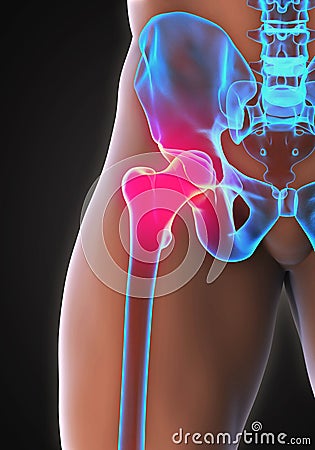 Painful Hip Joint Stock Photo