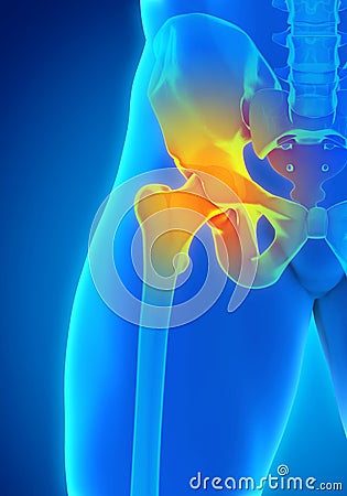 Painful Hip Joint Stock Photo