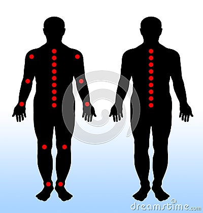 Painful joints Stock Photo