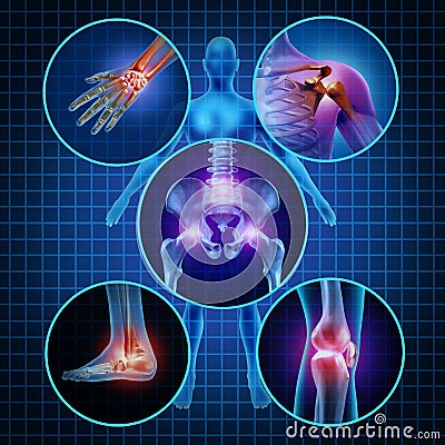 Painful Joints Stock Photo