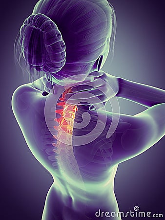 Painful neck - visible spine Stock Photo