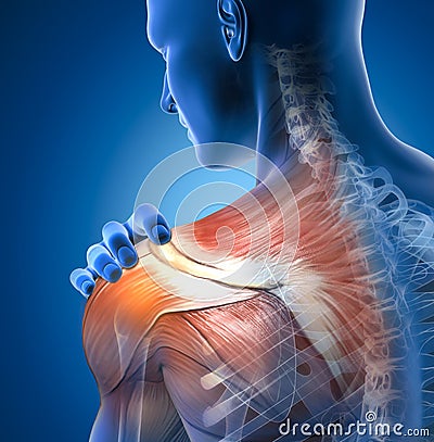 Painful shoulder joints. Frozen shoulder, Impingement. 3D illustration Stock Photo