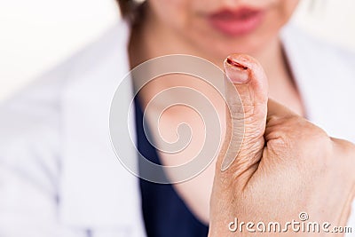 Painful thumb finger with cut injury Stock Photo