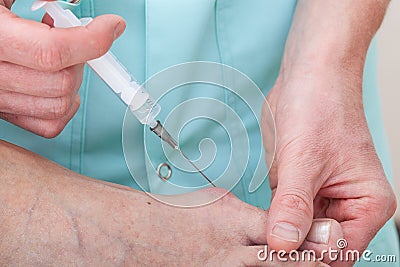 Painkiller injection Stock Photo