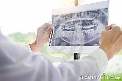 Panoramic dental X-ray of a human jaw holding in the hands of the dentist Stock Photo
