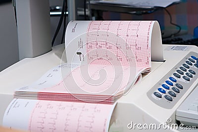 Paper read-out of treadmill test Stock Photo