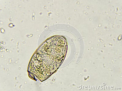 Paragonimus westermani (lung fluke) Stock Photo