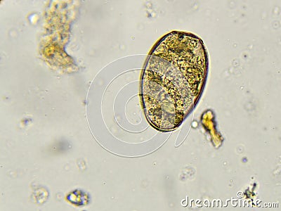 Paragonimus westermani (lung fluke) Stock Photo