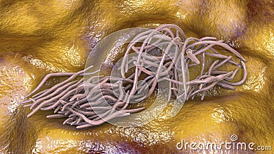 Parasitic worms in intestine Cartoon Illustration