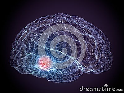 Parkinson degenerative brain diseases Stock Photo