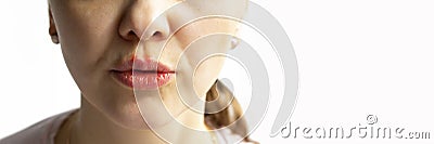 Part of a young woman face with red bubbles of virus herpes on lips Medicine, treatment. Long horizontal banner with Stock Photo