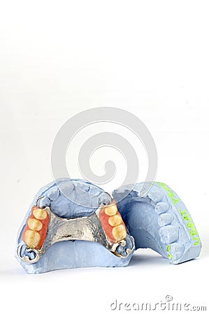 Partial denture 7 Stock Photo