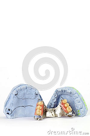 Partial denture 5 Stock Photo