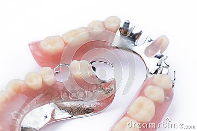 Partial denture upper side on a white background Stock Photo