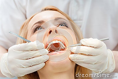 Partial view of blonde woman at dental check up Stock Photo