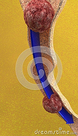 Path of food, digestion, bolus, intestine Stock Photo