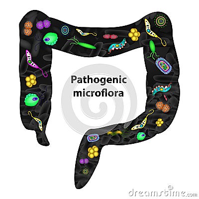 Pathogenic microflora in the intestine. Dysbacteriosis. Dysbiosis. Killed the good bacteria flora in the colon Vector Illustration