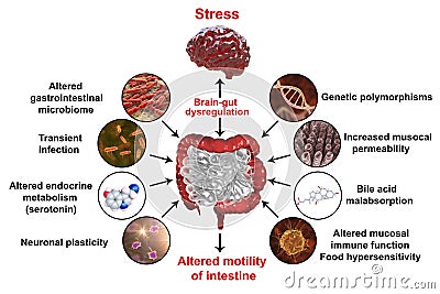 Irritable bowel syndrome IBS medical concept Cartoon Illustration