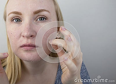 A woman examines dry skin on her face. Peeling, coarsening, discomfort, skin sensitivity. Patient at the appointment of a Stock Photo