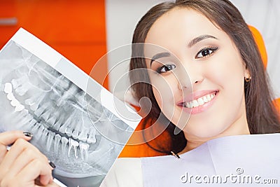 Patient beautiful girl holding x-ray picture of her teeth Stock Photo