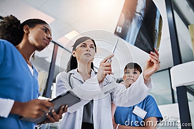 Patient care is a joint effort. a group of doctors discussing the results of an X-ray in a hospital. Stock Photo